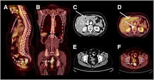 A322bcec Petct.jpg