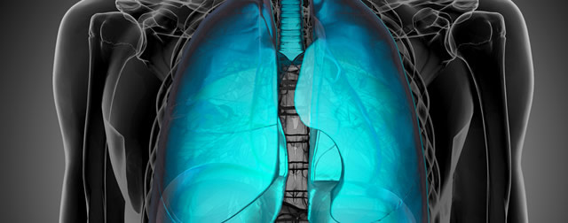 lung-scan