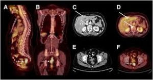 A322bcec Petct.jpg